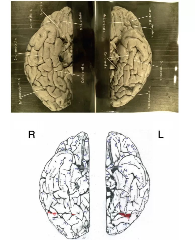 a close-up of Albert Einstein's brain