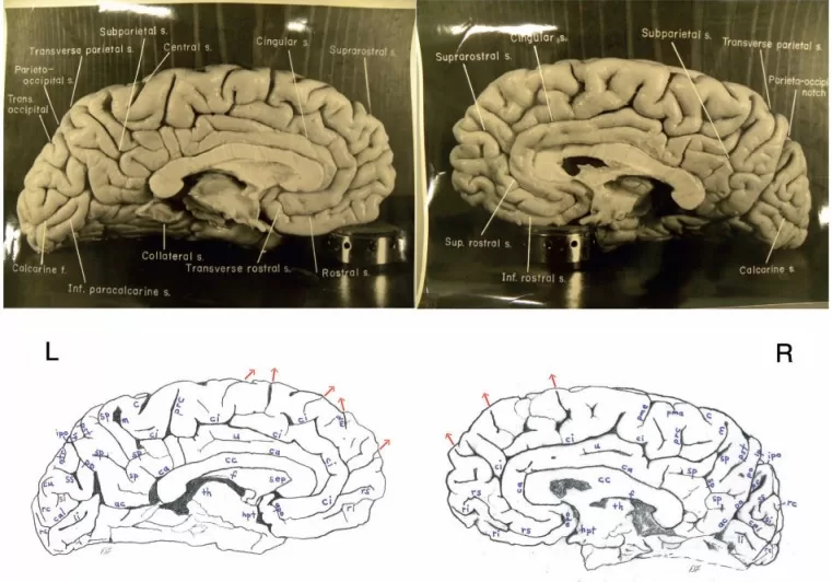 a close-up of Albert Einstein's brain